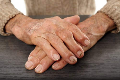 Avantajele curcumei versus medicamente antiinflamatorii
