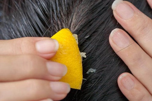Tratamentul cu lămâie împotriva căderii părului