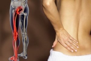 Durerea sciatică tratată cu 6 exerciții simple