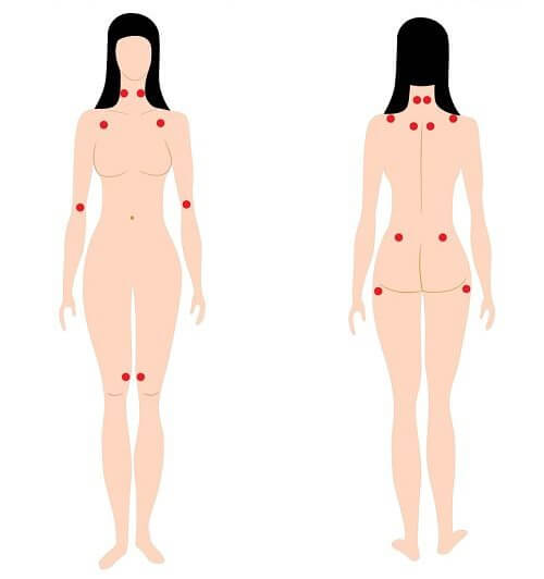 Fibromialgia își are originea în sistemul nervos central