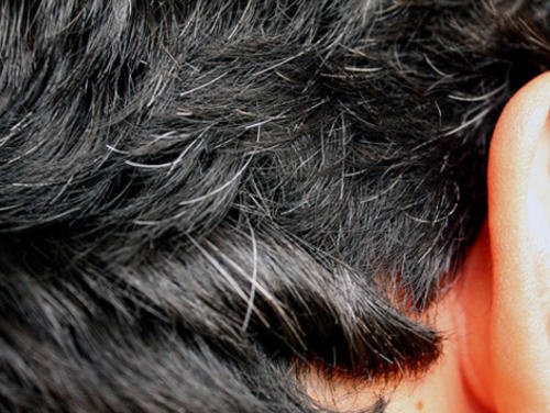 Părul grizonat timpuriu – 6 remedii naturiste