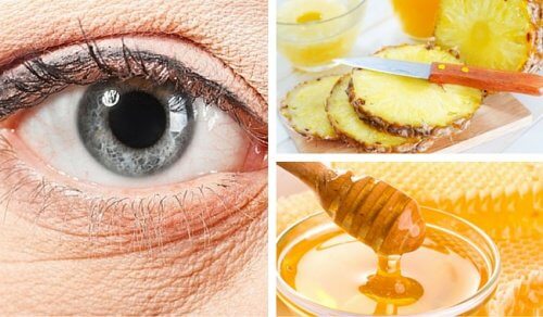 Ridurile de sub ochi – un tratament cu ananas