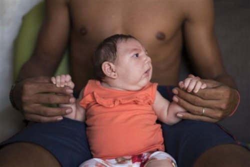 Virusul Zika provoacă microcefalie la copiii nou-născuți