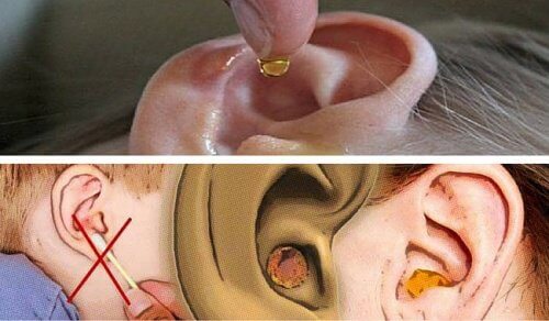Ceara din urechi: metode naturale de eliminare