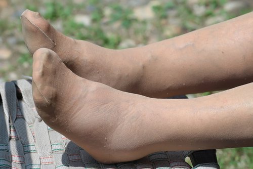 Picioarele umflate pot fi însoțite de durere