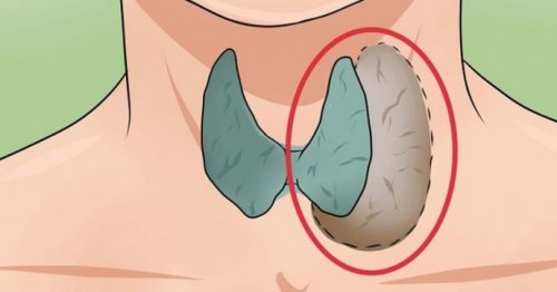 Bolile tiroidiene – 7 semnale de alarmă