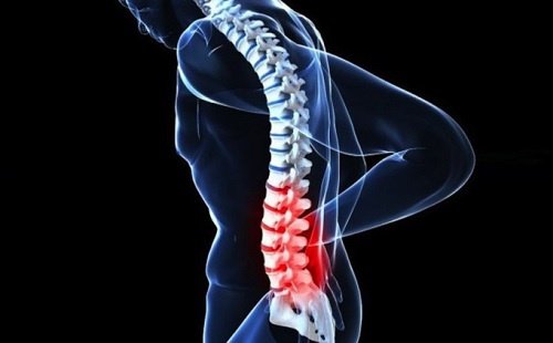 Tipuri de cancer la coloana vertebrală