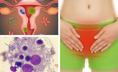 7 sfaturi pentru tratarea infecțiilor vaginale