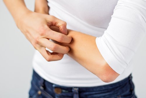 Mâncărimile pot fi un seamn referitor la acumularea toxinelor