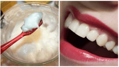 Problemele de sănătate orală: remediu cu ulei natural Problemele de sănătate orală: remediu cu ulei natural
