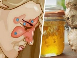 Combate sinuzita cu două ingrediente