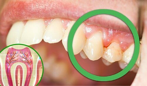 Durerea de dinți: 6 cauze frecvente
