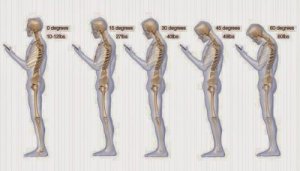 6 obiceiuri care provoacă dureri cervicale