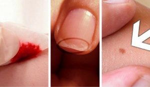 5 motive pentru care apelăm la un medic dermatolog