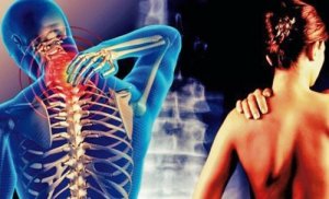 Nevralgia cervico-brahială: informații utile
