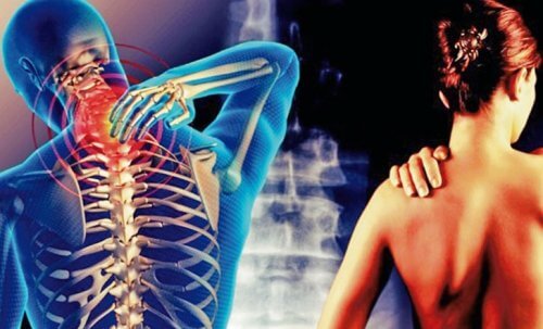 Nevralgia cervico-brahială: informații utile