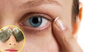 derma anti-imbatranire crema recenzii picioare de ciorb sub ochi cum se elimina
