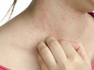 5 simptome ale diabetului mai puțin cunoscute