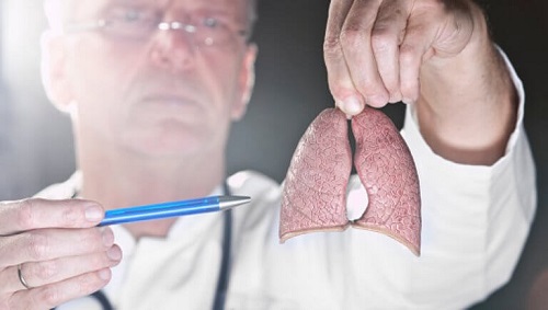 A fost creat un vaccin anticancer pulmonar