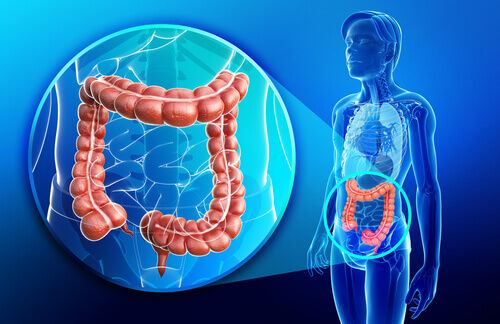 Boala Crohn afectează intestinele