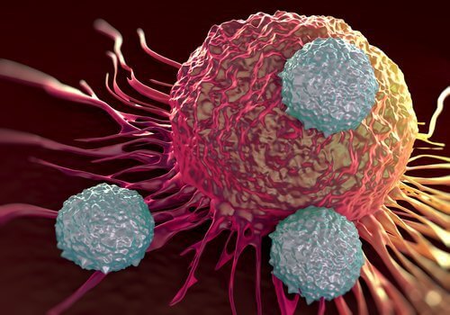 Crioblatia pentru cancerul mamar durează puțin peste jumătate de oră