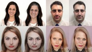 10 efecte negative ale stresului asupra înfățișării tale