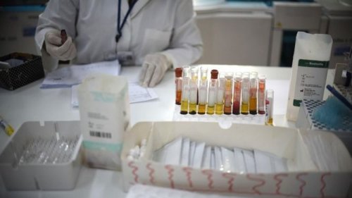Febra hemoragică Crimeea-Congo este o boală periculoasă