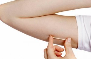 Implantul contraceptiv subdermic: informații esențiale
