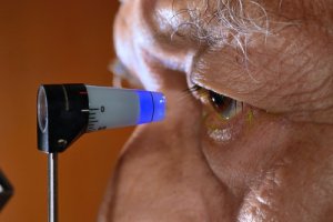 Metode naturale de prevenire a glaucomului