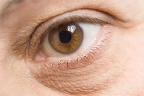 Pungile de sub ochi pot fi efecte negative ale stresului