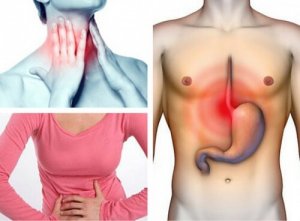 Cum poți afla dacă suferi de reflux gastroesofagian?