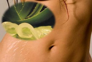 6 remedii naturiste pentru a ameliora vergeturile