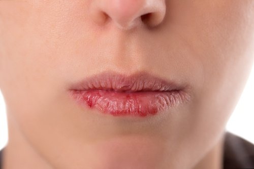 hpv mouth pain simptome infectie cu oxiuri