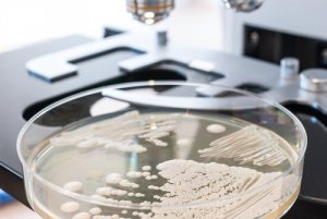 10 alimente pentru prevenirea candidozei