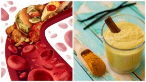 5 remedii naturiste pentru arterele înfundate