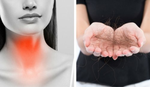 Căderea părului cauzată de afecțiunile tiroidei: 8 soluții