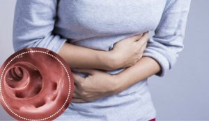 Alimentele recomandate pentru tratarea diverticulozei