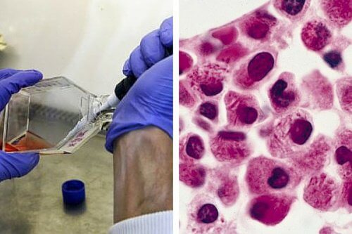Testare de moleculă pentru a trata cancerul