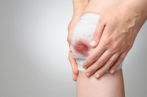 Vindecă rănile cu 3 plante medicinale incredibile