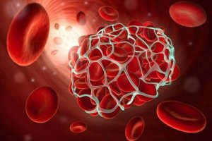 9 alimente care pot să prevină tromboza și atacul cerebral