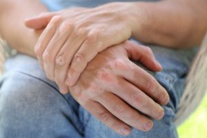 Tratament vitiligo: 8 opțiuni naturale