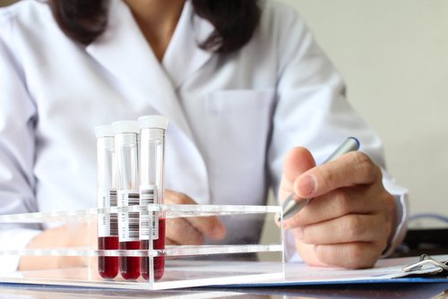 Anemia pe lista de simptome ale cancerului de colon