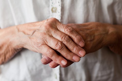 Ce este artrita reumatoidă care afectează articulațiile