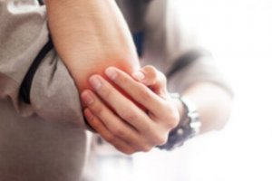 5 remedii naturale pentru bursită