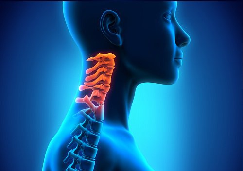 Nevoia de tratamente pentru spondiloza cervicală