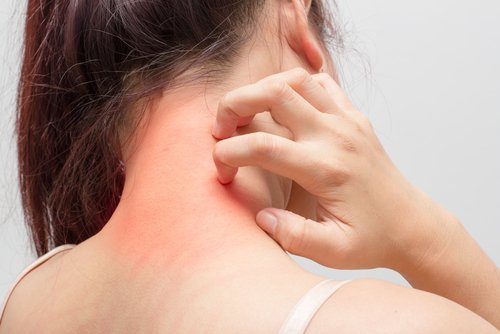 Păpădia ajută la tratarea eczemei