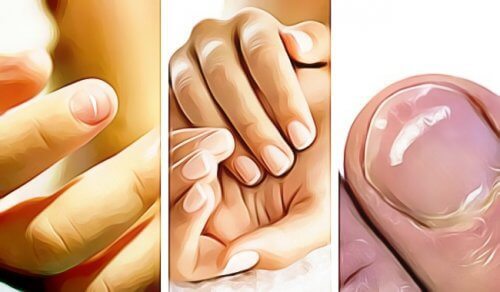 5 semne că unghiile indică o problemă de sănătate
