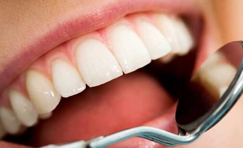 Beneficiile apei cu castravete pentru dinți