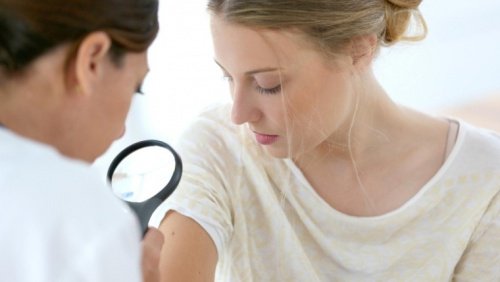 Medic care examinează simptome ale cancerului de piele