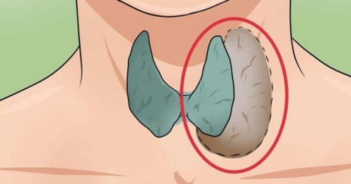 dureri articulare din glanda tiroidă)
